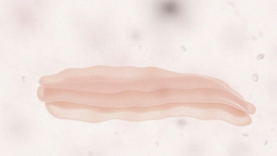 Jak zbudowane są keratynocyty?