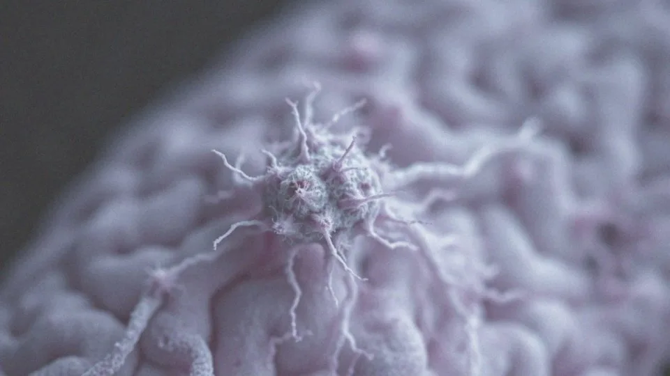 Blizna glejowa – co to jest i jak wpływa na układ nerwowy?